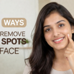 20 Ways to Remove Dark Spots on Face